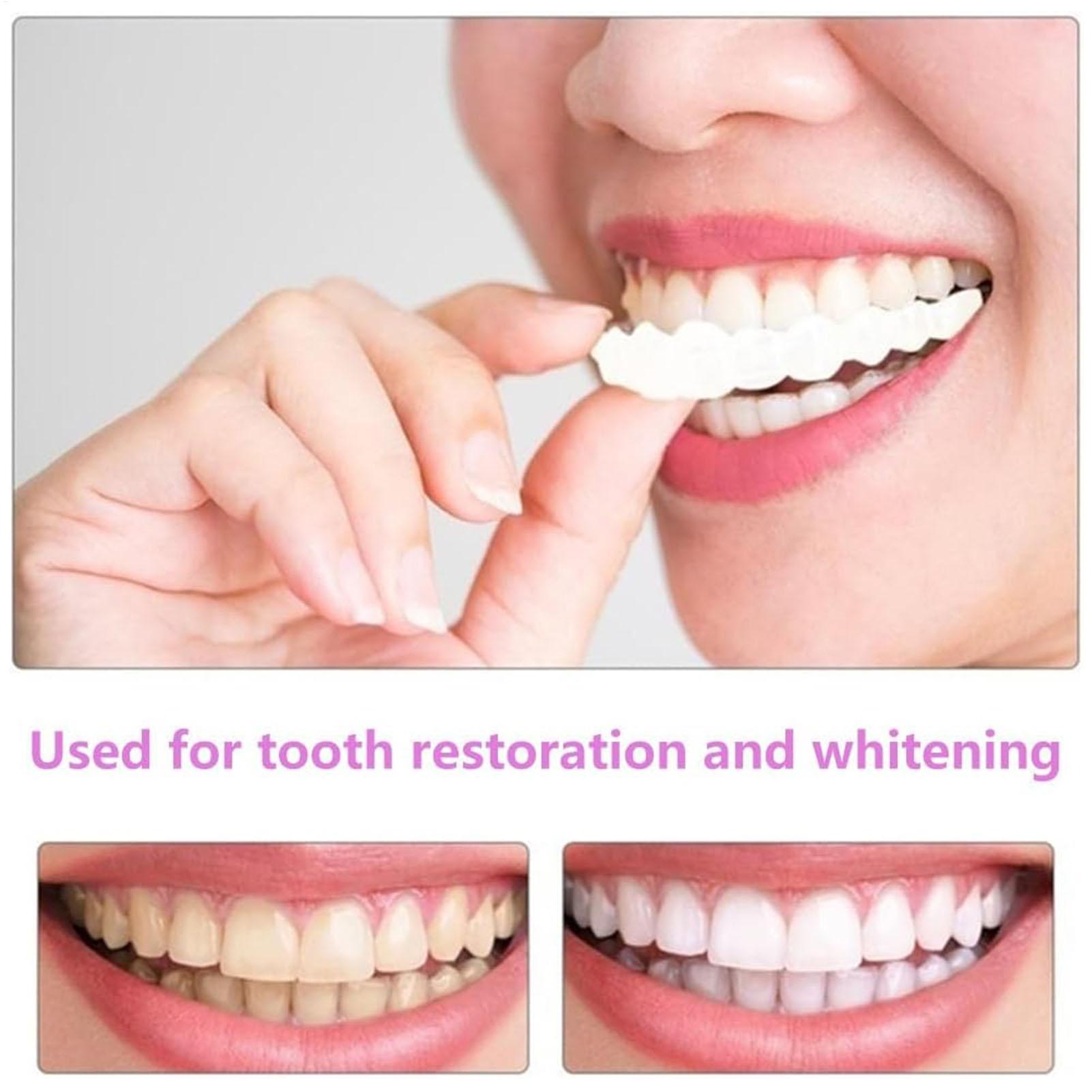 1 пара долгосрочного винила дл – обзор и цена Teeth Whitening Fast