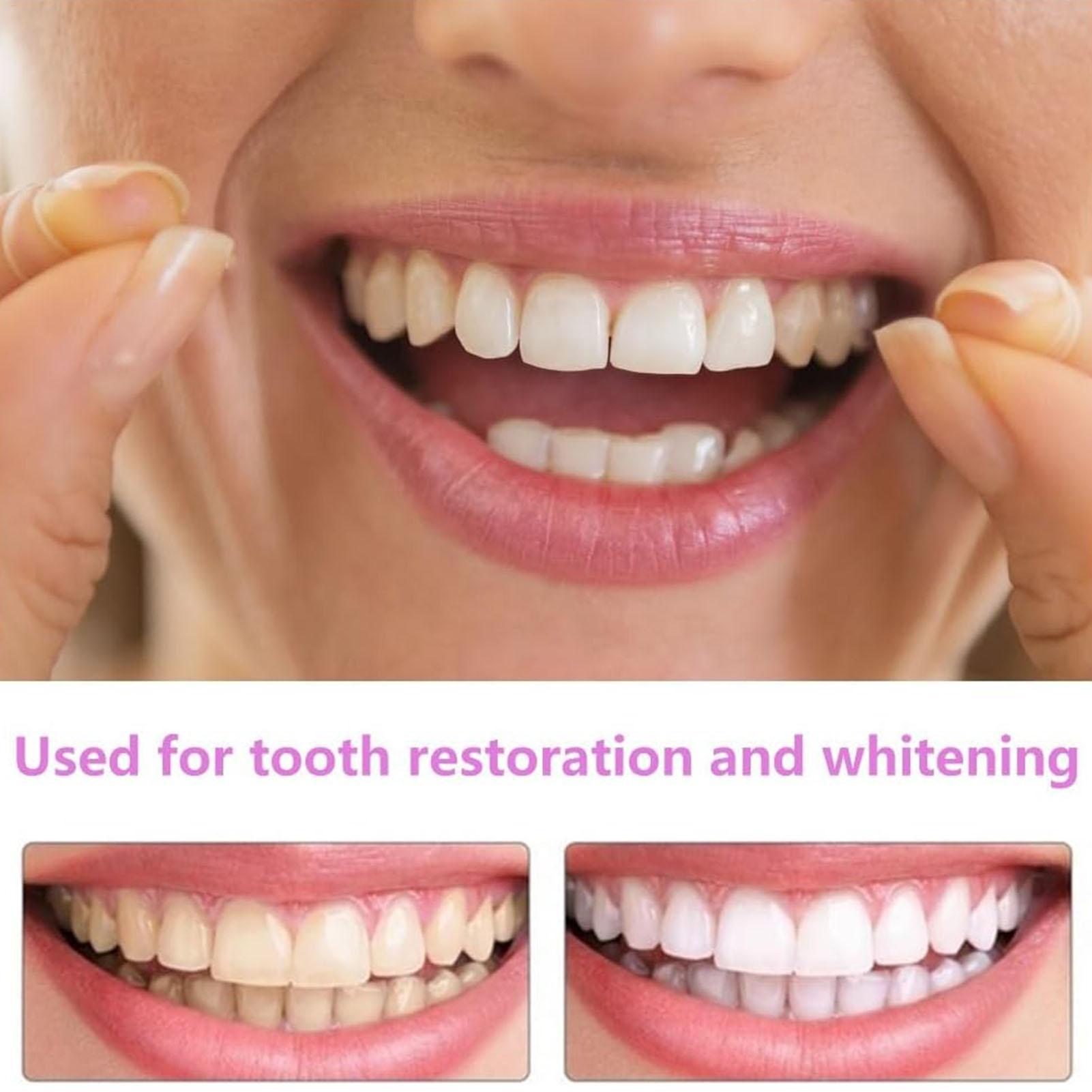 1 пара долгосрочного винила дл – обзор и цена Teeth Whitening Fast