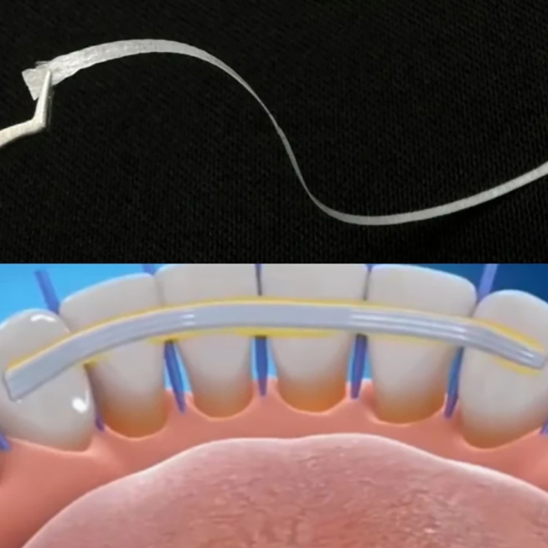 1/5 шт. Стекловолоконные полос – обзор и цена Teeth Whitening Laser