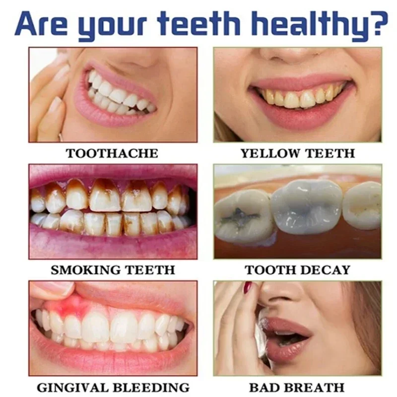 Быстрое удаление пятен дыма Зу – обзор и цена Teeth Whitening Fast