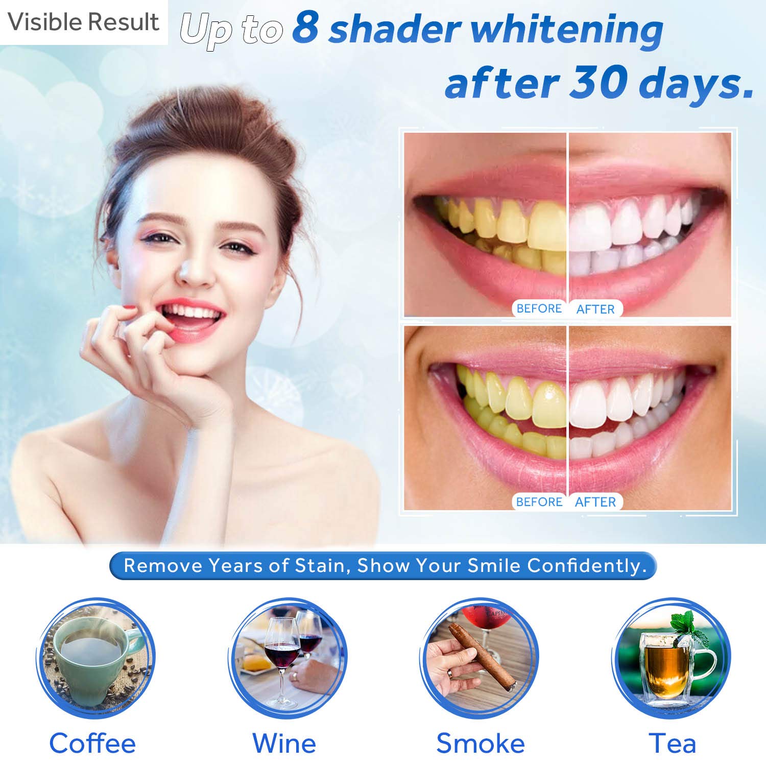 Гель для отбеливания зубов, шп – обзор и цена Teeth Whitening Laser