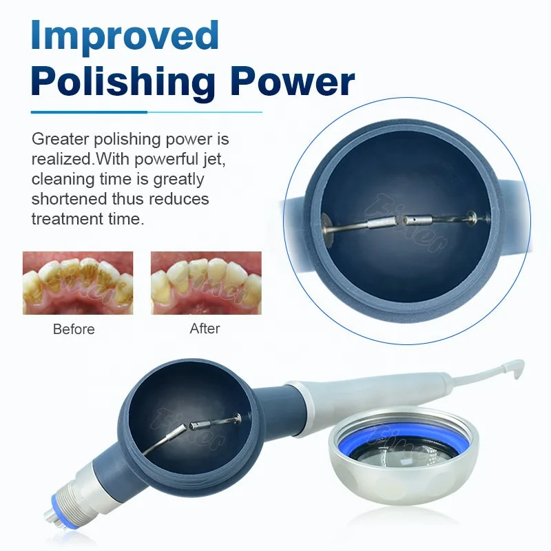 Prophy Mate Чистка зубов Отбел – обзор и цена Teeth Whitening Fast