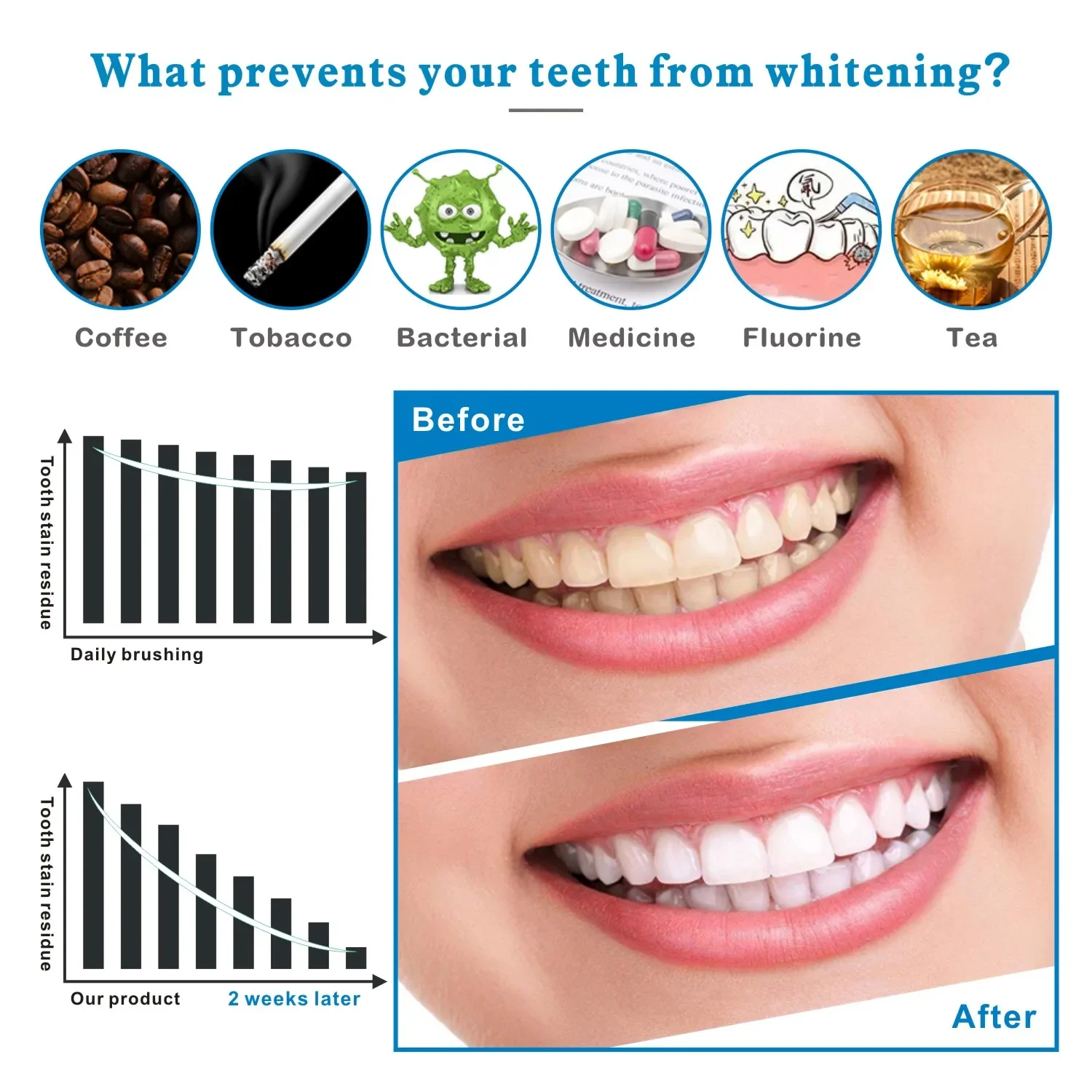 14/28 шт. 3D полоски для отбел – обзор и цена Whitening Strip 3D